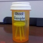 stool-sample1