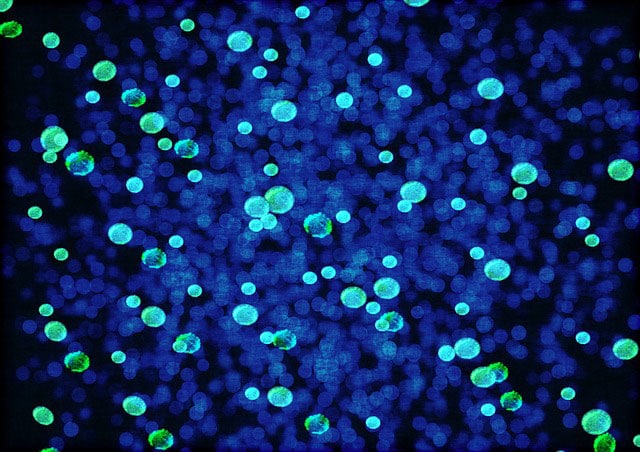 High Dose B12 and Lung Cancer